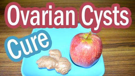 Diet plan for the patients of ovarian cyst