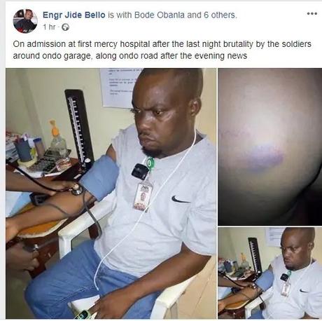 Coronavirus lockdown: NTA staff allegedly brutalized by soldiers in Ondo Coronavirus lockdown: NTA staff allegedly brutalized by soldiers in Ondo