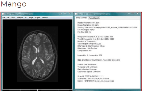 download the last version for android Sante DICOM Viewer Pro 12.2.5