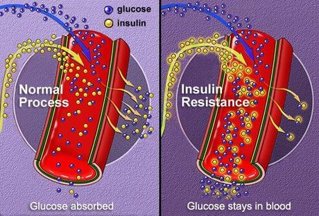 Type 2 Diabetes latest #Type2Diabetes Normal insulin absorption vs. insulin resistance.