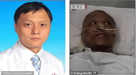 Chinese doctors who were critically ill with COVID-19 wake up to find that their skin has turned dark after the virus damaged their livers (photos)