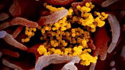CDC chief says there could be second, possibly worse coronavirus outbreak this winter