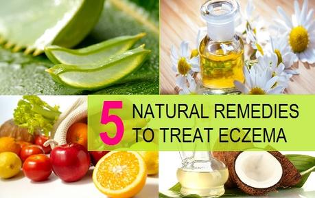 Some Home Remedies and Preventive measures for Eczema