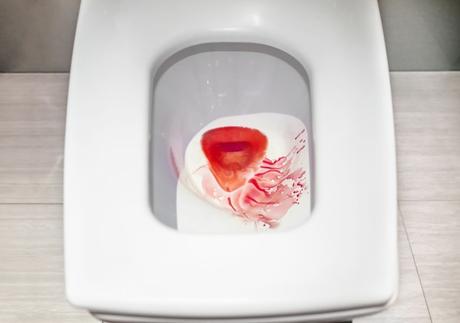 Best Toilet Seat For Hemorrhoids