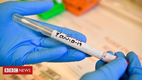 Coronavirus: Virus deaths error blamed on computer system