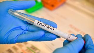 Coronavirus: Virus deaths error blamed on computer system
