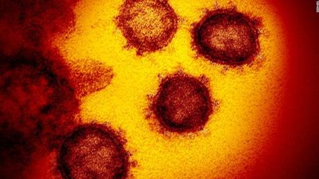 Coronavirus pandemic: Updates from around the world