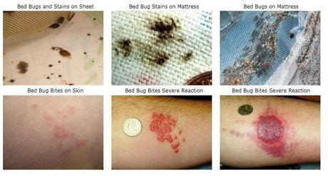 Signs and Symptoms of Bed Bugs