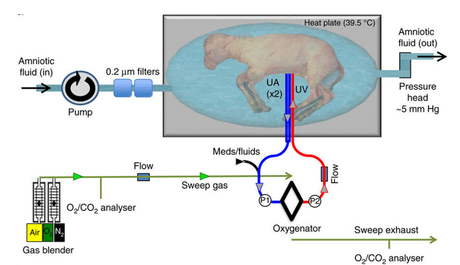 Artificial Womb Diagram