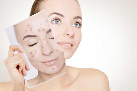 The Most Common Skin Problems and How to Fix Them