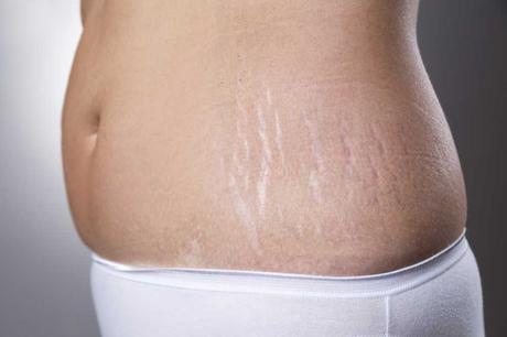 The Most Common Skin Problems and How to Fix Them