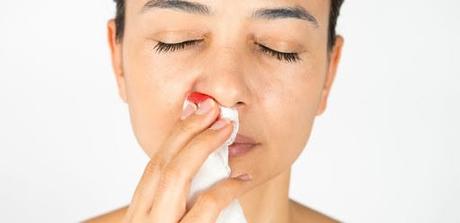 Epistaxis and its Ayurvedic Treatment