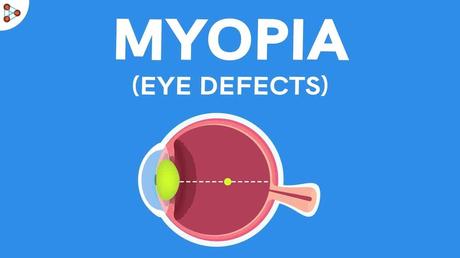 How to treat Myopia through Ayurveda?