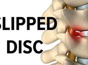 Treat Slipped Disc Through Ayurveda?