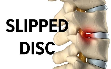 How to Treat Slipped Disc through Ayurveda?