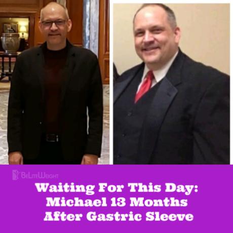 Waiting For This Day: Michael 13 Months After Gastric Sleeve