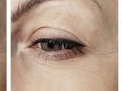 Ways Avoid Formation Wrinkles Around Your Eyes