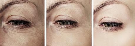 5 Ways to Avoid Formation of Wrinkles Around your Eyes