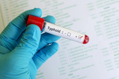 What is Typhoid? Symptoms, Causes and Ayurvedic Treatment