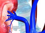 Connection Between Kidney Transplant Cost Medical Tourism India