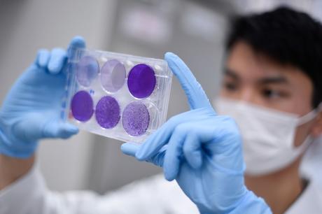 covid-19:-brazil-invests-in-the-development-of-the-experimental-vaccine