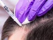 Management Hair Loss Market Analysis Report With COVID-19 Impact Industry 2026 Oreal, Unilever, Taisho, Henkel, Merck