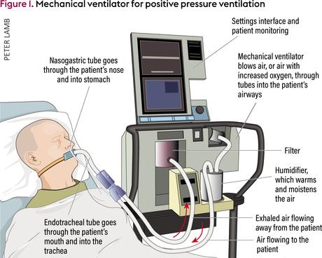 Remember the ventilator