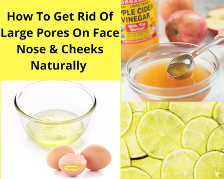How To Get Rid Of Large Pores On Face, Nose, Cheeks Naturally