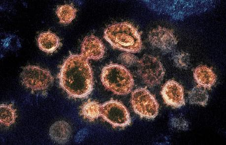 Difference Between Coronavirus and Covid 19 | Compare the Difference Between Similar Terms