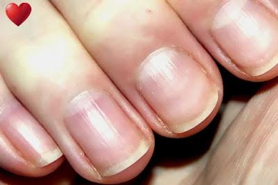 24 Signs Your body is Deficient in Vital Nutrients. 24 Signs Your body is Deficient in Vital Nutrients.