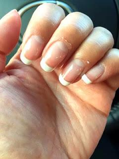 24 Signs Your body is Deficient in Vital Nutrients. 24 Signs Your body is Deficient in Vital Nutrients.