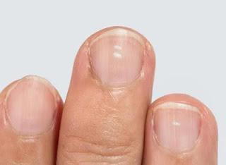 24 Signs Your body is Deficient in Vital Nutrients. 24 Signs Your body is Deficient in Vital Nutrients.