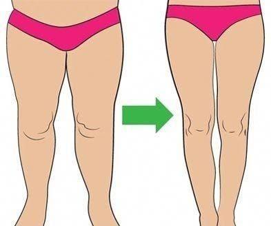 Slim Legs Home Workout | Do It Before Sleeping || Fitness Yodha