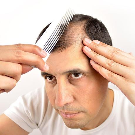 The Reason of Losing Hair and Ayurveda Treatment to Cure