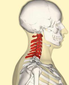 Neck Spasms: 9 Causes You Need to Know