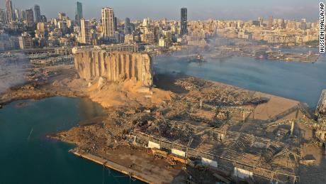 Beirut blast survivor: The world can’t let this chaos go on