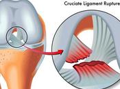 (Anterior Cruciate Ligament) Herbal Treatment