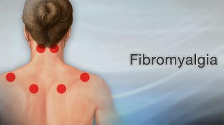 What is Fibromyalgia? How to cure it Naturally