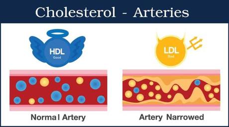 Cholesterol Test: What you need to know?