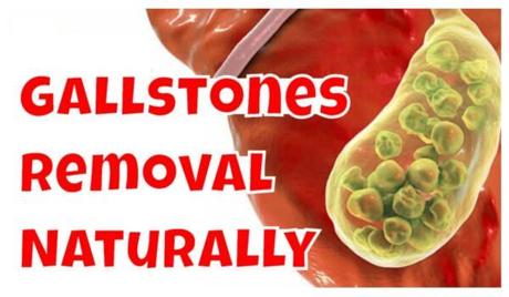 What is Gallbladder? How to Remove Gall stones Naturally? What is Gallbladder? How to Remove Gall stones Naturally?