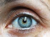 Dark Circle Removal Causes Available Treatments