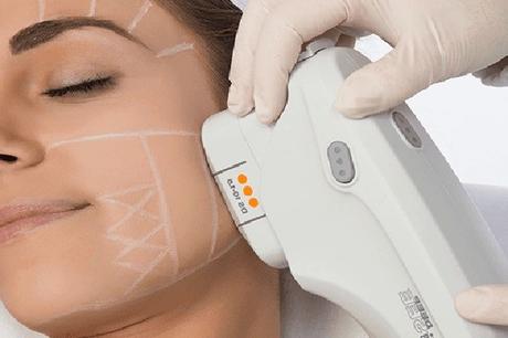 The Top 10 Skin Therapies With Great Results