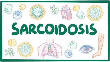 What is Sarcodosis? Causes, Symptoms and Ayurvedic Treatment