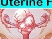 Uterine Fibroid Ayurvedic Herbal Treatment