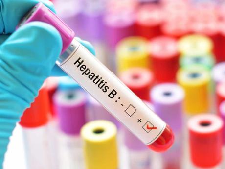 What is Hepatitis? Symptoms, Care and Treatment