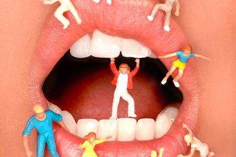 Improving Your Smile With Dental Implants