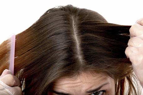 How to Stop Hair Loss in Women?