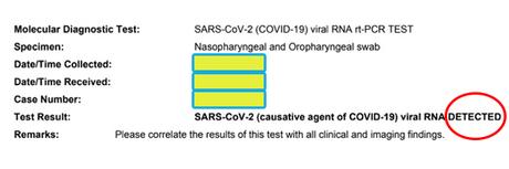 covid positive result