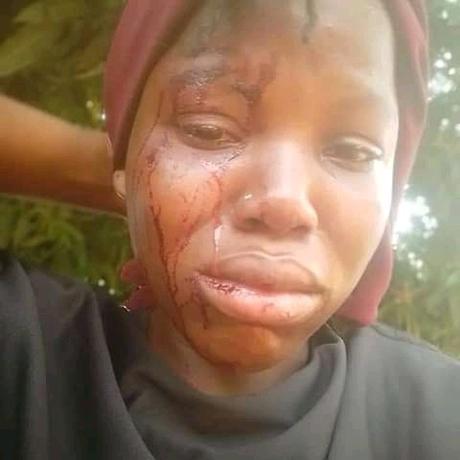 Stepmother Stabs OAU Student In Osun Over Grater (Photo)