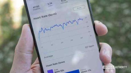 A hybrid smartwatch with ECG A hybrid smartwatch with ECG